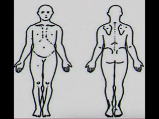 Animação ilustrando áreas de dor no corpo